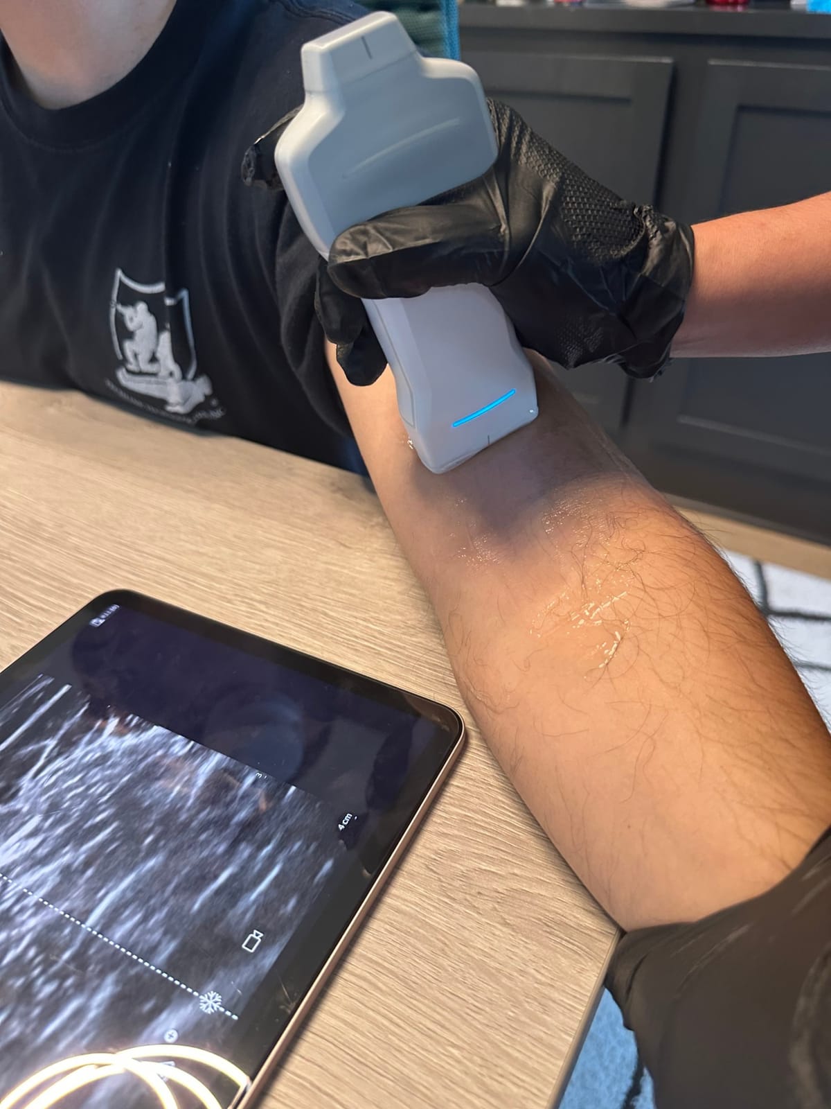 Close-up of the handheld ultrasound probe on a client's forearm